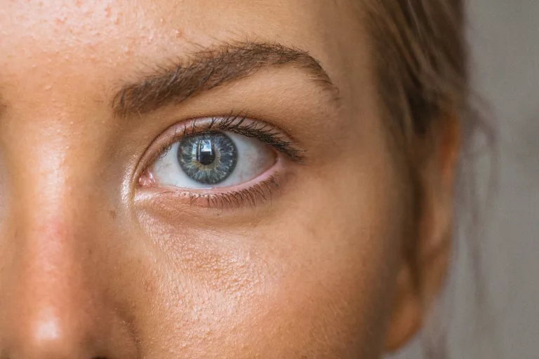 Why Is My Skin So Oily?