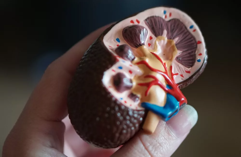 kidney scale model in hand