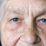 Why We Get Wrinkles: Exploring the Aging Process and Key Factors