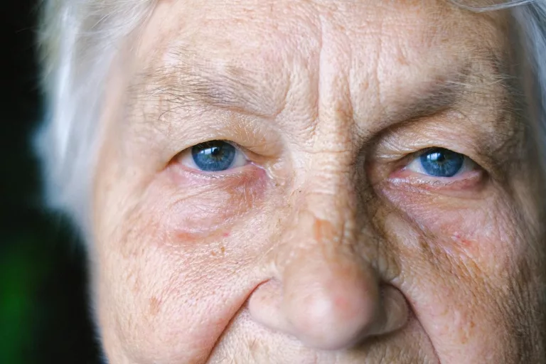 Why Do We Get Wrinkles? Investigating the Aging Process and Factors Contributing to Skin Wrinkles