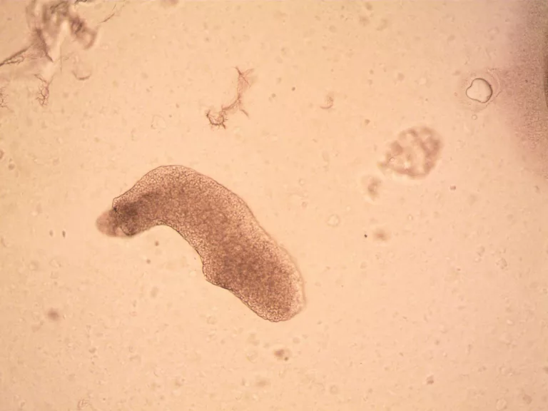 How Extremophiles Thrive in the Harshest Environments on Earth