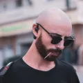 Why Men Suffer from Baldness More Than Women: The Science, Myths, and Surprising Truths