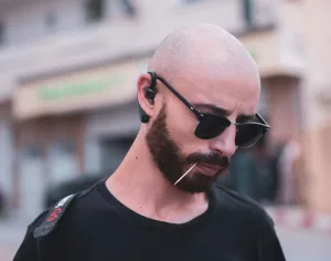 Why Men Suffer from Baldness More Than Women: The Science, Myths, and Surprising Truths