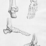 Is Leg-Lengthening Surgery Worth the Risk? What It Is, How It Works and Why It’s Not as Simple as Getting Taller
