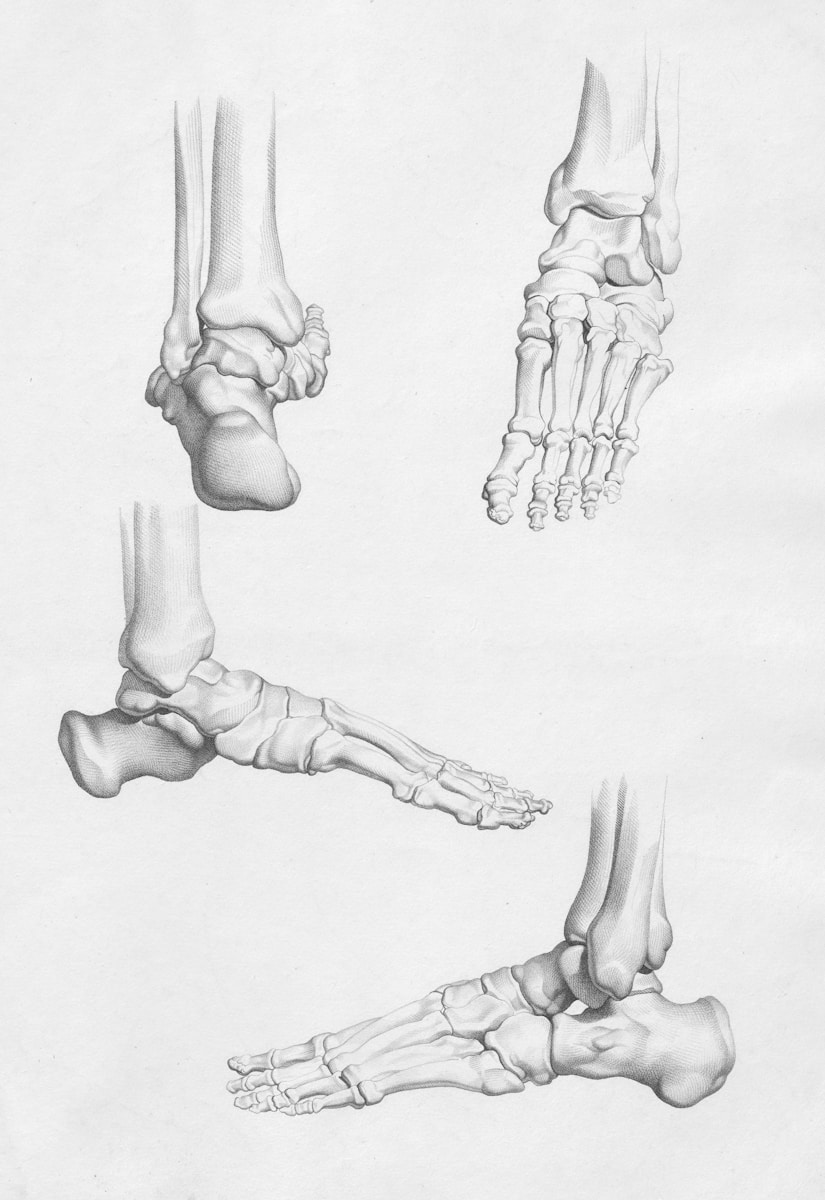 Medical diagram showing leg-lengthening surgery technique on femur bone